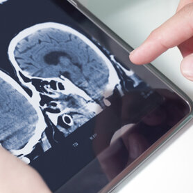 Tablet mit CT-Scan Das Bild zeigt ein von zwei Händen gehaltenes Tablet mit einem CT-Scan eines menschlichen Schädels.