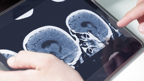 Das Bild zeigt ein von zwei Händen gehaltenes Tablet mit einem CT-Scan eines menschlichen Schädels.