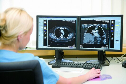 Bildgebende Diagnostik auf Monitoren Eine Frau betrachtet auf zwei Monitoren die Ergebnisse der bildgebenden Diagnostik.